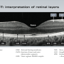 cirrus_oct_interpretion_of_retinal_layers.png